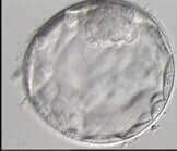 kariera czy dziecko: blastocysta