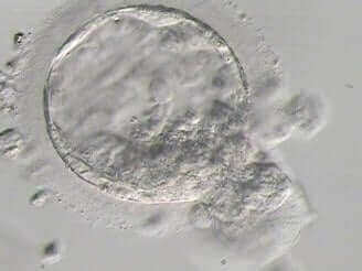 rozwijający się zarodek